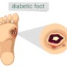 diabetic foot pain