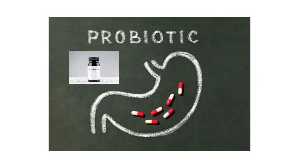 Probiotic supplement, Which dietary supplement, multivitamin probiotic, omega 3