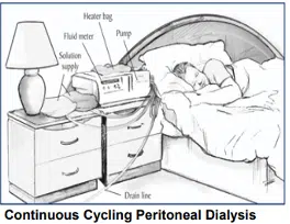 CCPD, peritoneal dialysis type