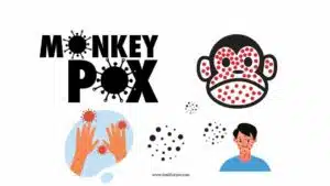Monkeypox pictures, MPXV, Monkey Pox, Monkeypox 2022