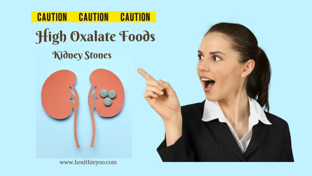 High oxalate foods, oxalates, kidney stones