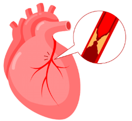 heart protection for prevention of genitourinary disease