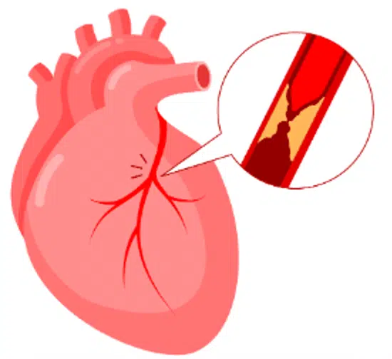 heart protection for prevention of genitourinary disease