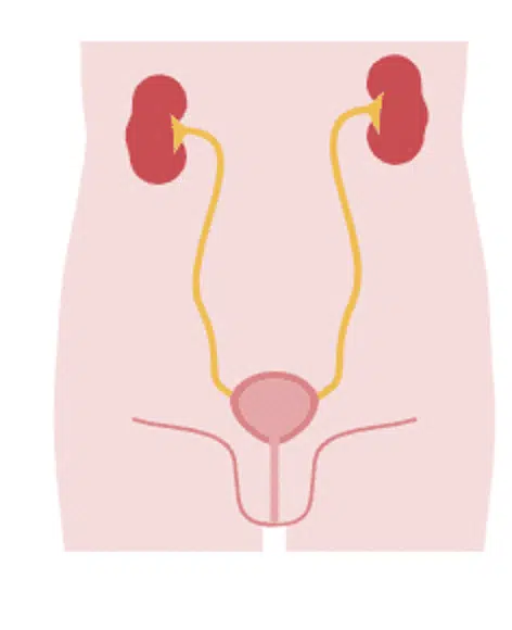 Urinary stress incontinence