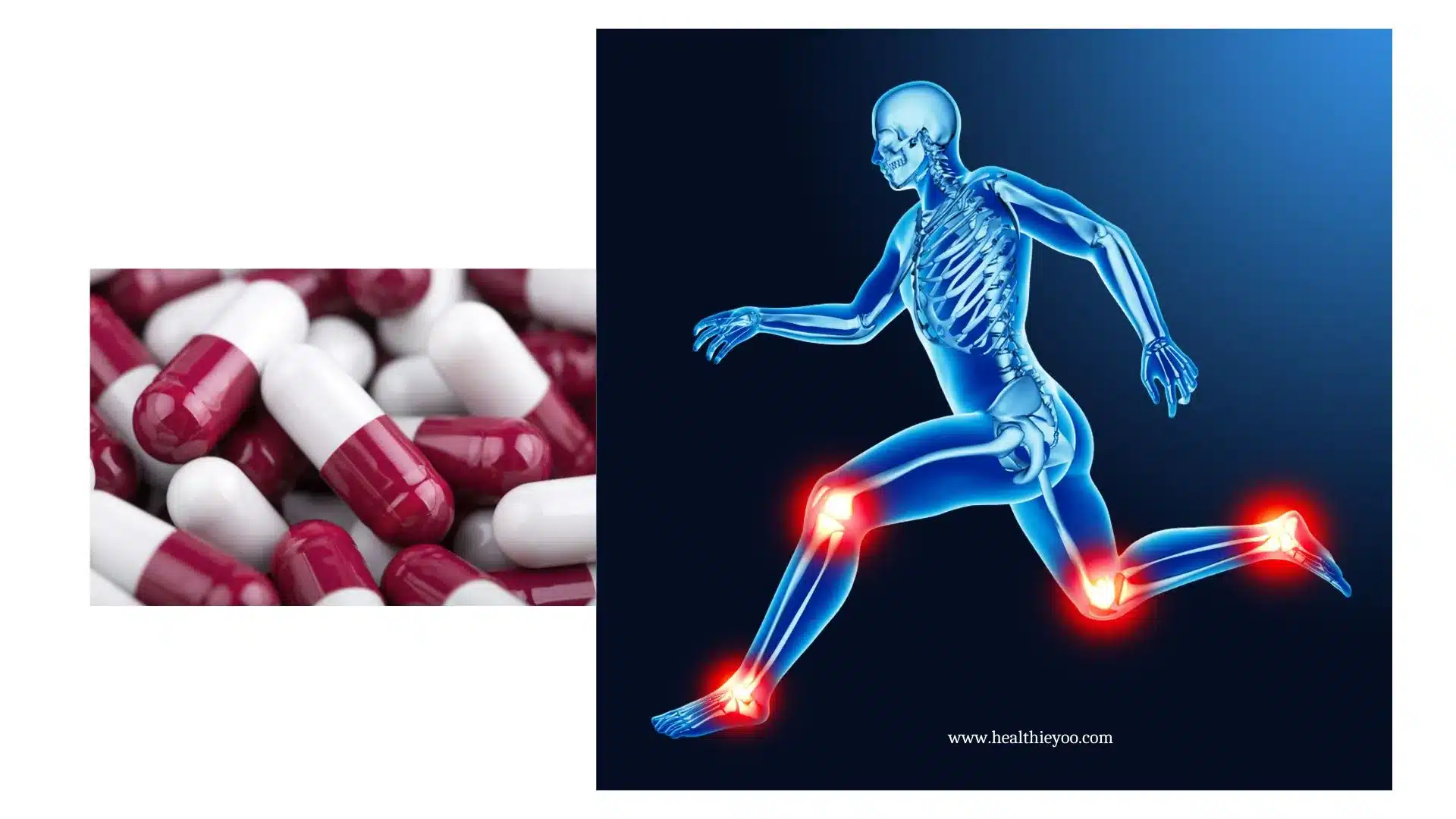 Physio Flex Pro, Physio Flex Pro Joint supplement, Reviews, Side effects, Ingredients, Bioperine, Kashin Beck disease