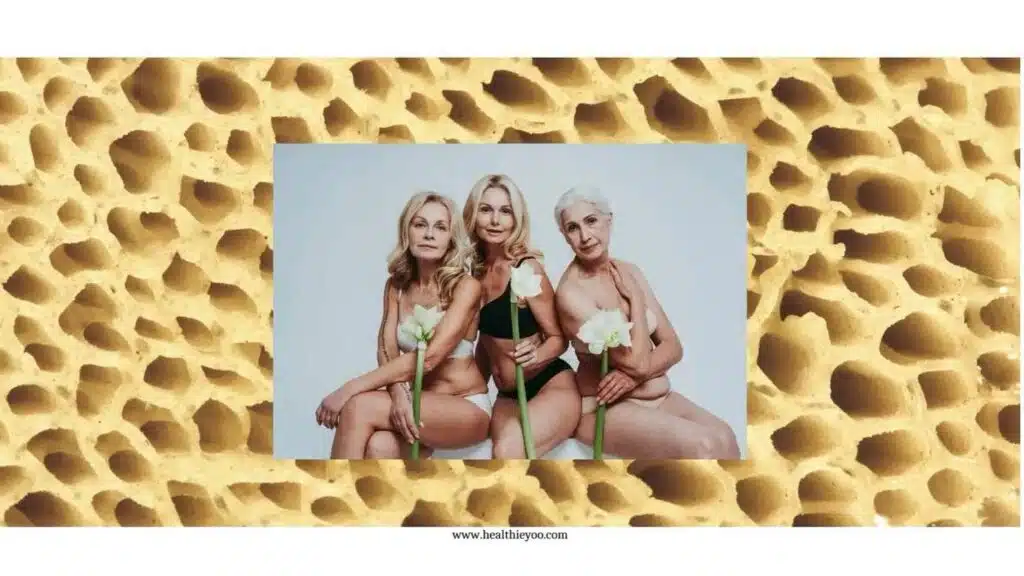 3 women surrounded by bone depicting osteoporosis in postmenopausal woman