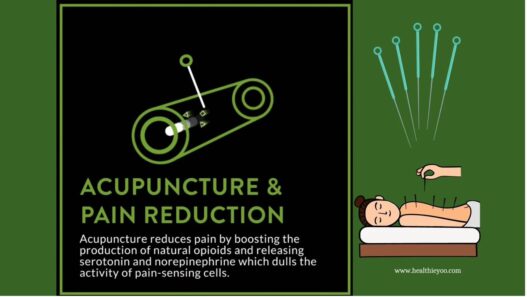 Acupuncture for pain reduction explained