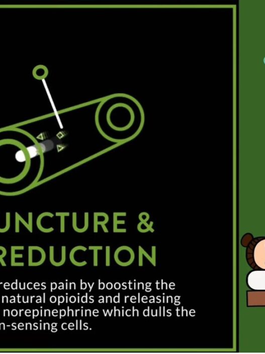 Acupuncture for pain reduction explained