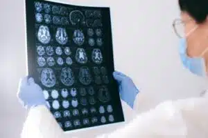 Brain mapping, neurofeedback, brain mapping therapy