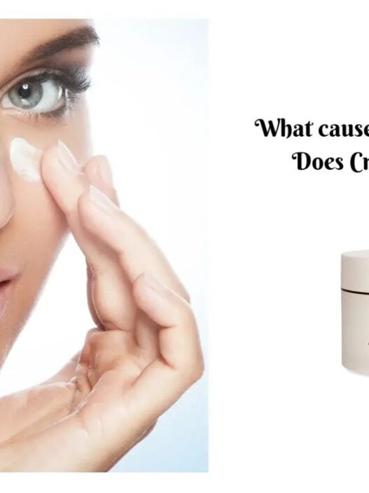 Woman applying crepe erase cream, Crepe erase reviews