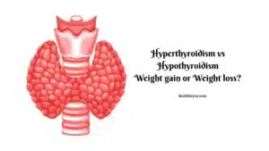 thyroid health, weight, hyperthyroidism, hypothyroidism, weight loss, weight gain