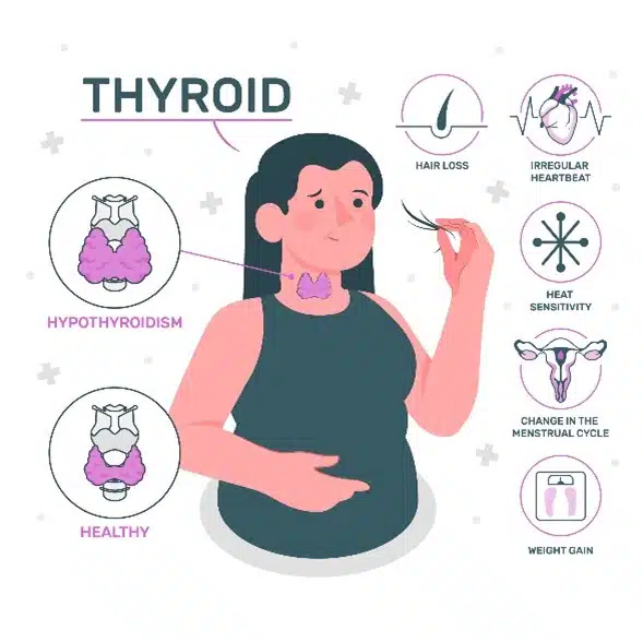 thyroid health, weight, hyperthyroidism, hypothyroidism, weight loss, weight gain