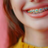 braces colors, best braces colors, woman with colored braces smiling, what is the best color for braces
