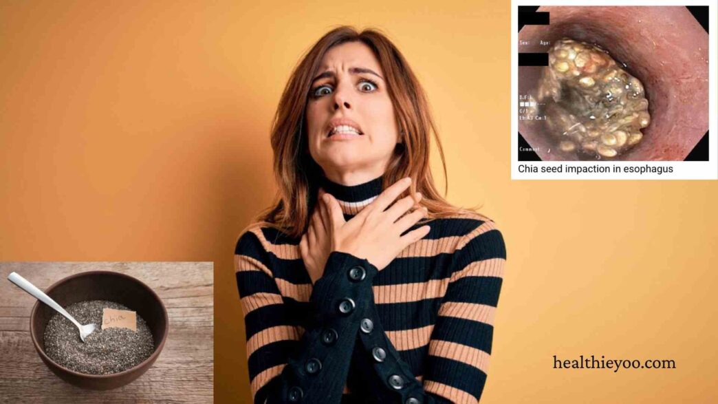 Woman choking with chia seeds, chia seeds side effects, are chia seeds a choking hazard